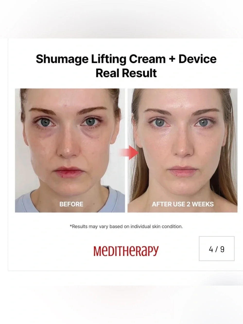MEDITHERAPY Shumage Gold Seal Lifting Cream+Device, Ultimate Lifting